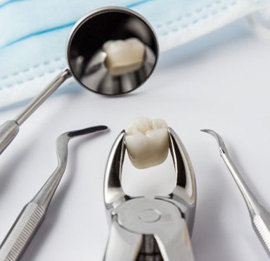 Extracted tooth grasped by forceps reflected in dental mirror