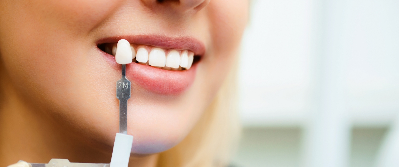 Woman's smile compared with dental crown restoration color option