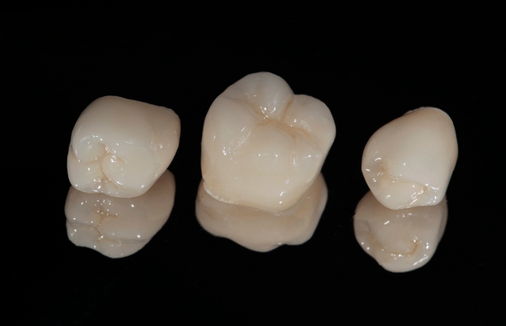 Three dental crowns prior to placement