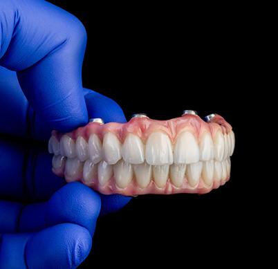 Implant dentures in Denton 