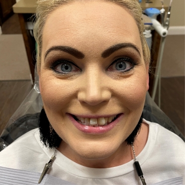 Woman smiling before cosmetic dentistry