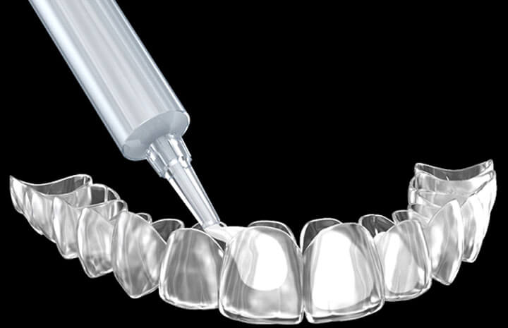 teeth whitening solution poured into a tray