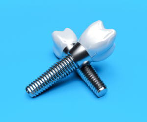 Two dental implants