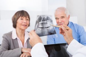 An older couple examining an X-ray.