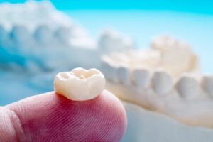 Close-up of dental crown. 