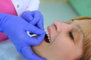 Woman getting veneers placed